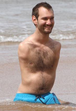 أشهر متحدّ للإعاقة في العالم يقضي شهر العسل مع زوجته الجديدة